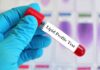 Why Regular Lipid Profile Tests Are Crucial for Heart Health
