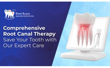 Comprehensive Root Canal Therapy at Dent Eazee: Save Your Tooth with Our Expert Care
